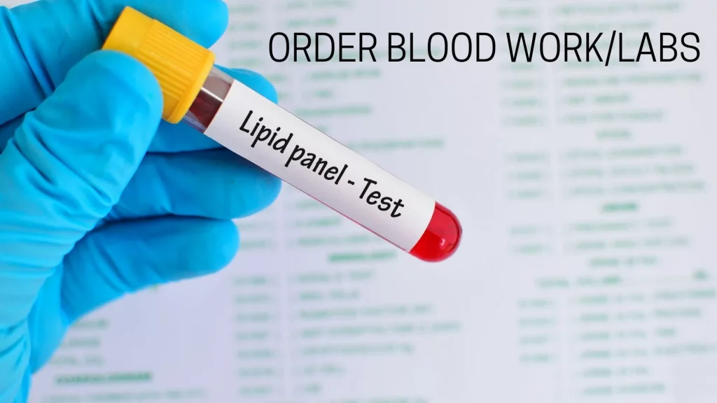 Lipid Panel Test
